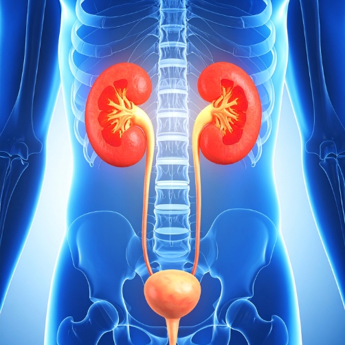 cálculos en en riñón